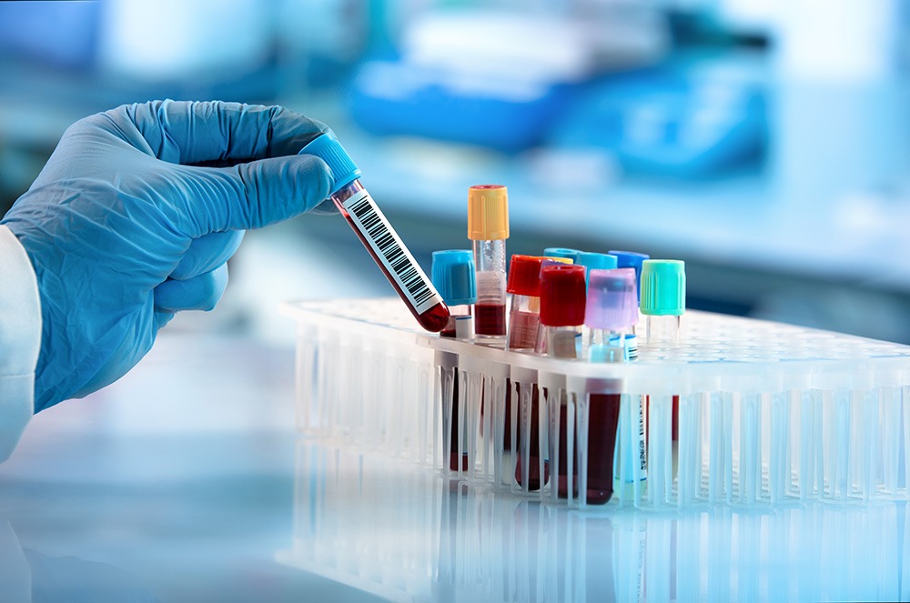 A gloved hand holds a blood sample vial above a rack containing multiple blood-filled test tubes with colored caps in a laboratory setting.